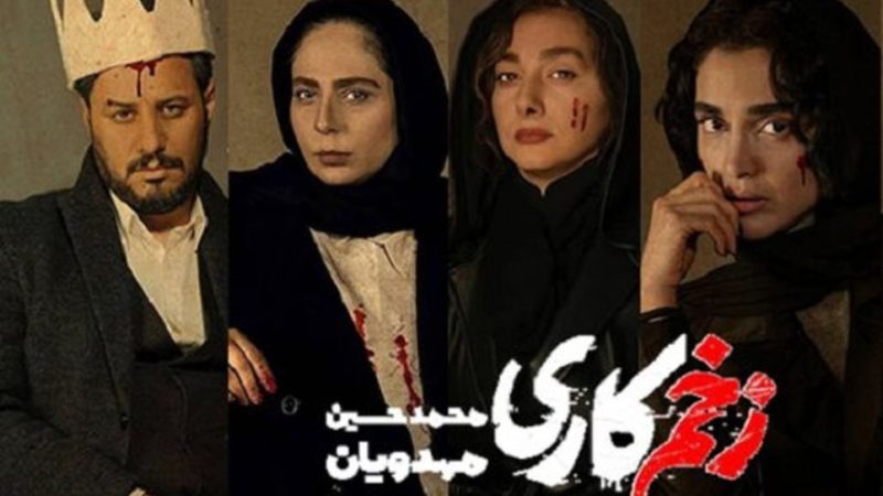 عکس های دیده نشده از خانم بازیگران زخم کاری در ترکیه! 