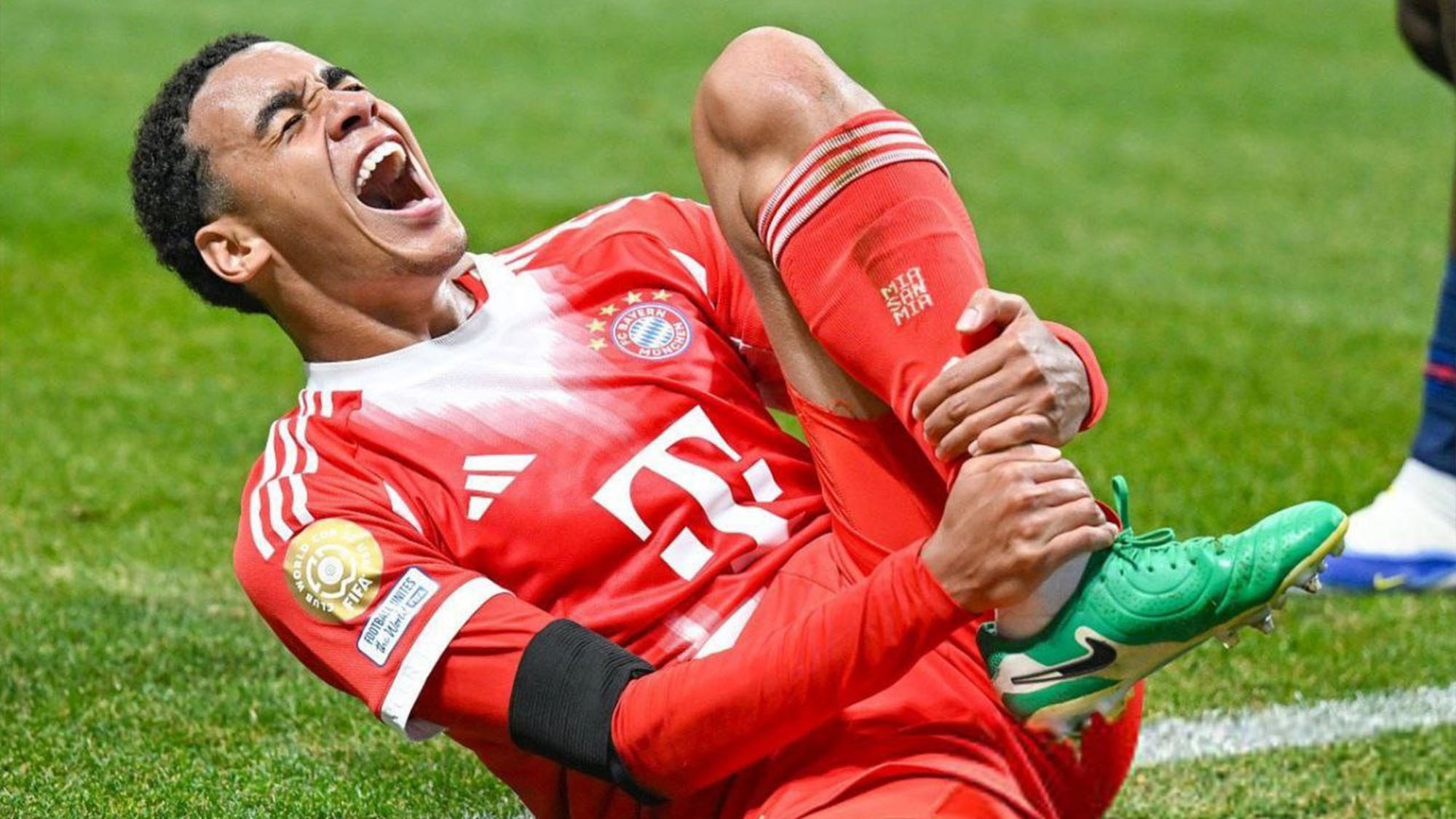 مصدومیت شدید موسیالا؛ شماره ۱۰ بایرن ۵-۶ ماه غایب است