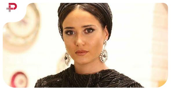 عکس/ پریناز ایزدیار با لک های قرمز جذابش دل پسران را برد 
