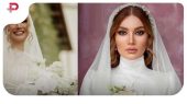 نگاه روز| عکس های قبل و بعد عمل زیبایی متین ستوده 