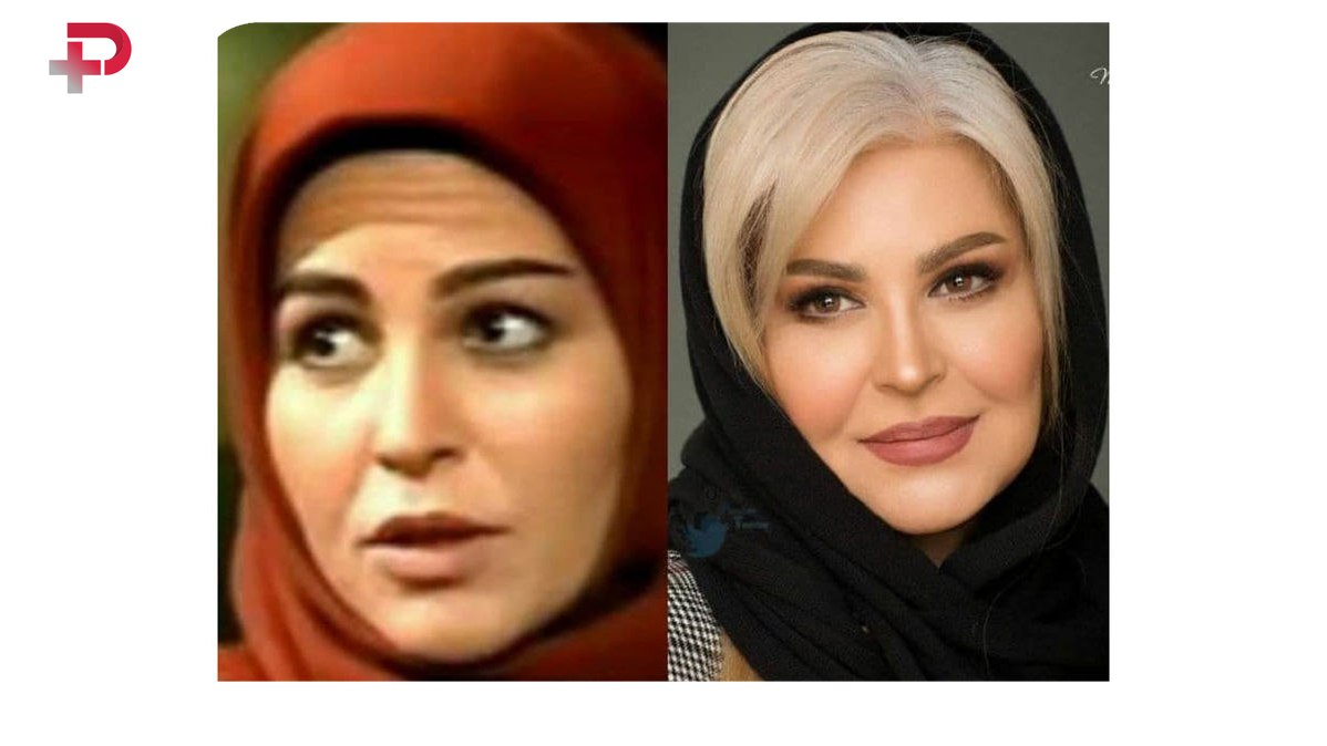 اکرم محمدی