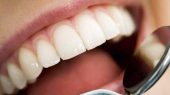 هشدار دندان ها به ما ؛ آیا رنگ دندان با بیماری‌های مختلف ارتباط دارد؟ 
