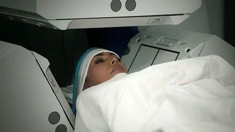 بیماری کیم کارداشیان چیست؟/ کانیه وست این بلا را سر کیم آورد