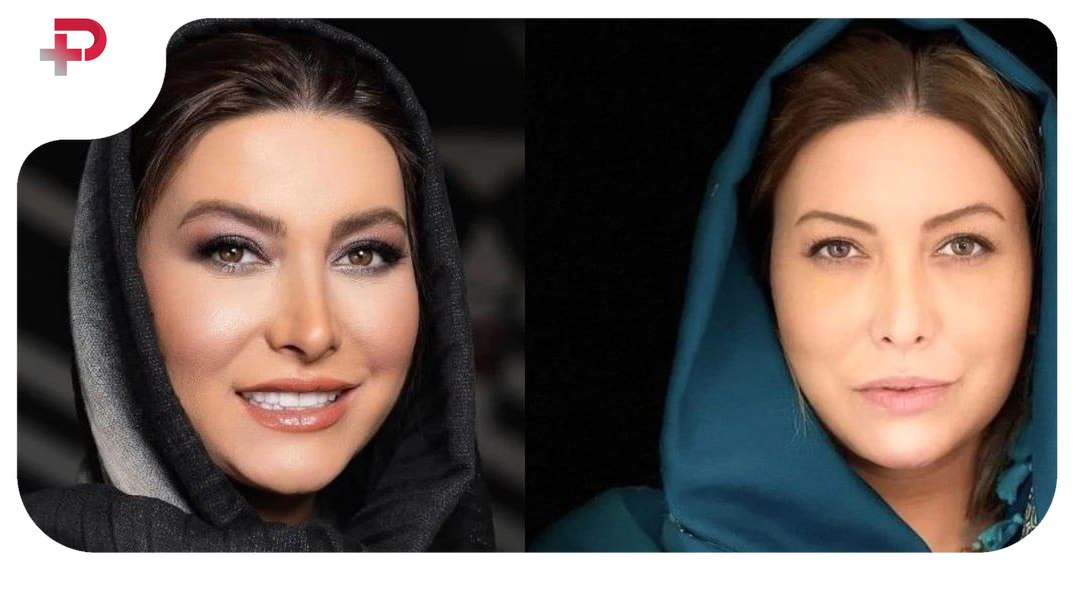 مسعود رسام شوهر اول فریبا نادری