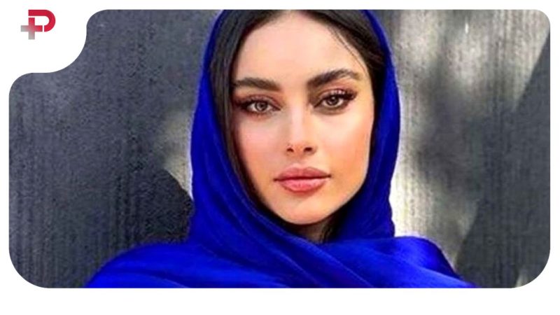 عکس | تغییر چهره شگفت آور از ترلان پروانه ؛ خانم بازیگر را اصلا نمی شناسید 