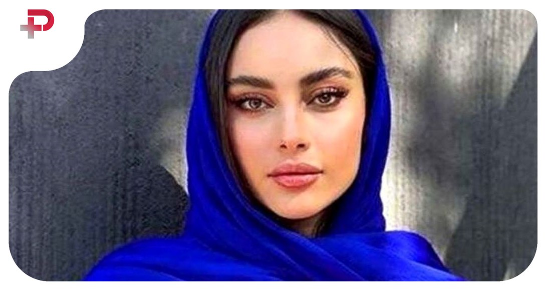 عکس | تغییر چهره شگفت آور از ترلان پروانه ؛ خان بازیگر را اصلا نمی شناسید
