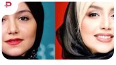 تصاویر| تغییرات چهره نازنین بیاتی از گذشته تا امروز ؛ جراحی های خانم بازیگر چه بود؟ 