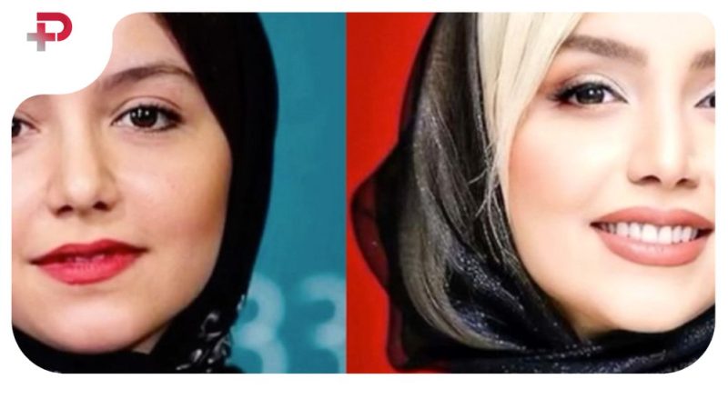 تصاویر| تغییرات چهره نازنین بیاتی از گذشته تا امروز ؛ جراحی های خانم بازیگر چه بود؟