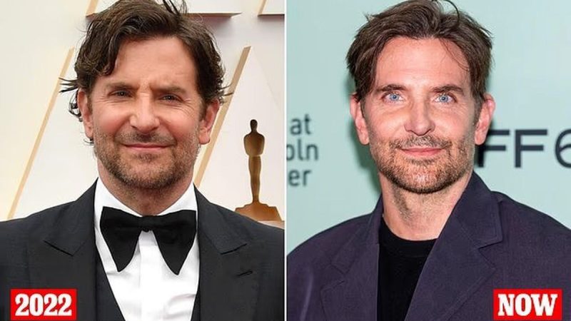 تغییر چهره بردلی کوپر ؛ اقای بازیگر مشهور جراحی زیبایی کرد؟