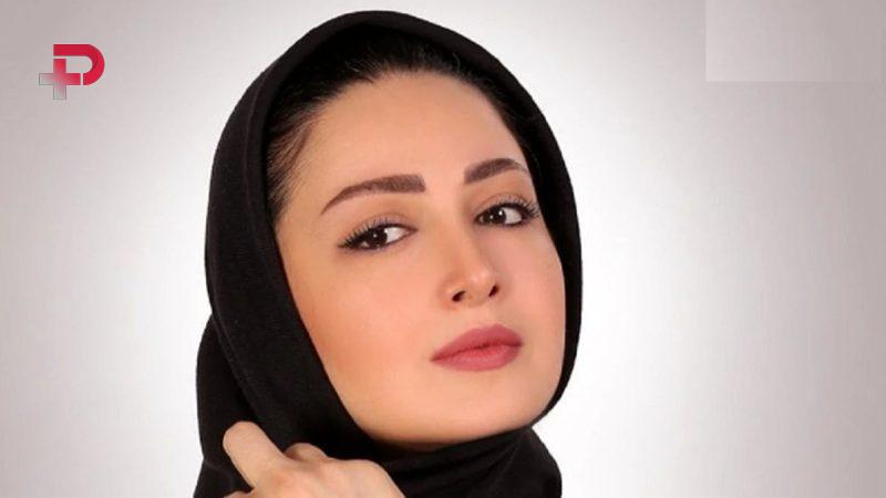 عکس قدیمی چهره «شیلا خداداد» قبل از جراحی زیبایی را دیده اید؟/ خانم بازیگر چقدر تغییر کرد