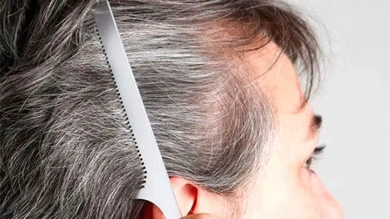 راهکارهای خانگی کاهش سفیدی مو/ چگونه از شر موهای سفید خلاص شویم