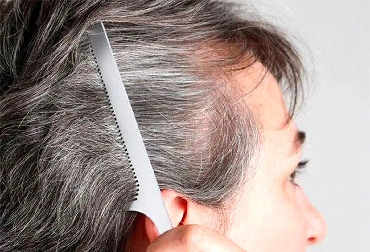 راهکارهای خانگی کاهش سفیدی مو/ چگونه از شر موهای سفید خلاص شویم
