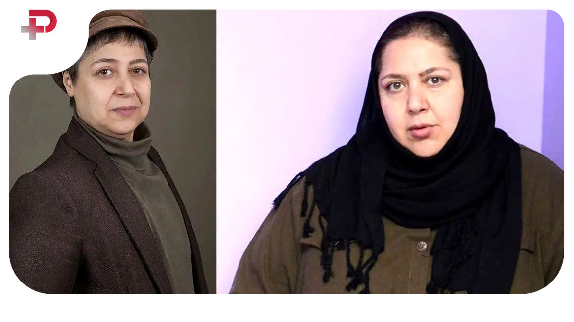 قبل و بعد تغییر جنسیت بازیگران ایرانی؛ رازهایی که تا حالا پنهان بودند - تصویر شاخص