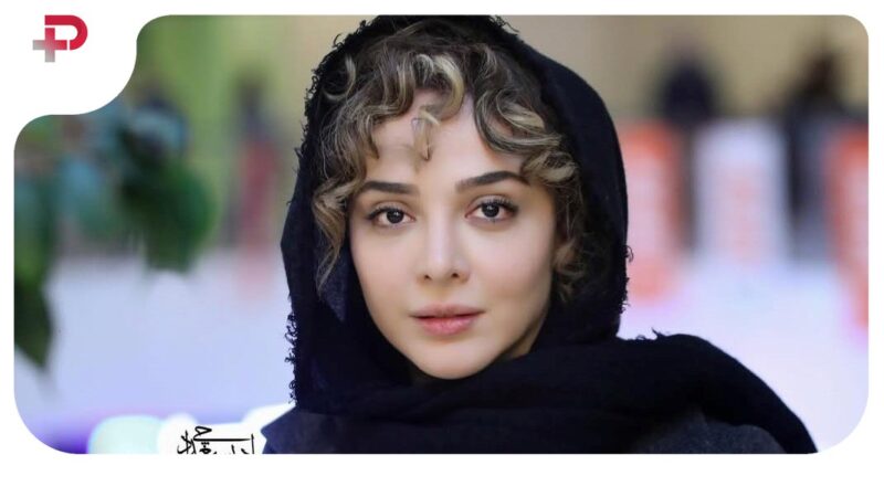 المیرا دهقانی با چهره‌ای بدون آرایش؛ جریان کبودی چشم خانم بازیگر چیه؟