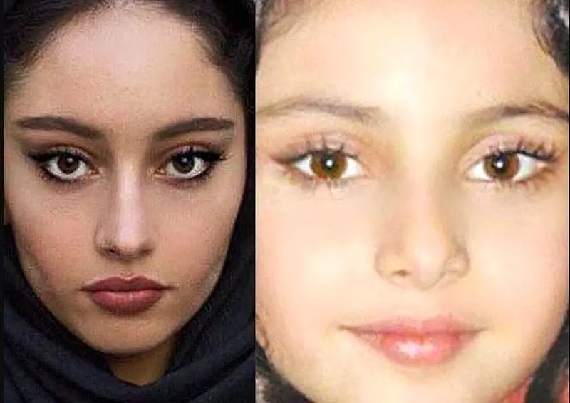 عمل زیبایی ترلان پروانه