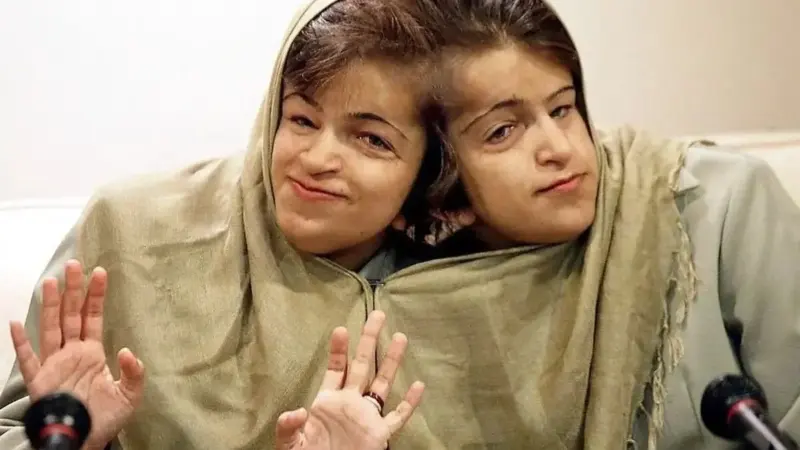 تصاویر| بیوگرافی و حواشی لاله و لادن خواهران محبوب دهه ۶۰