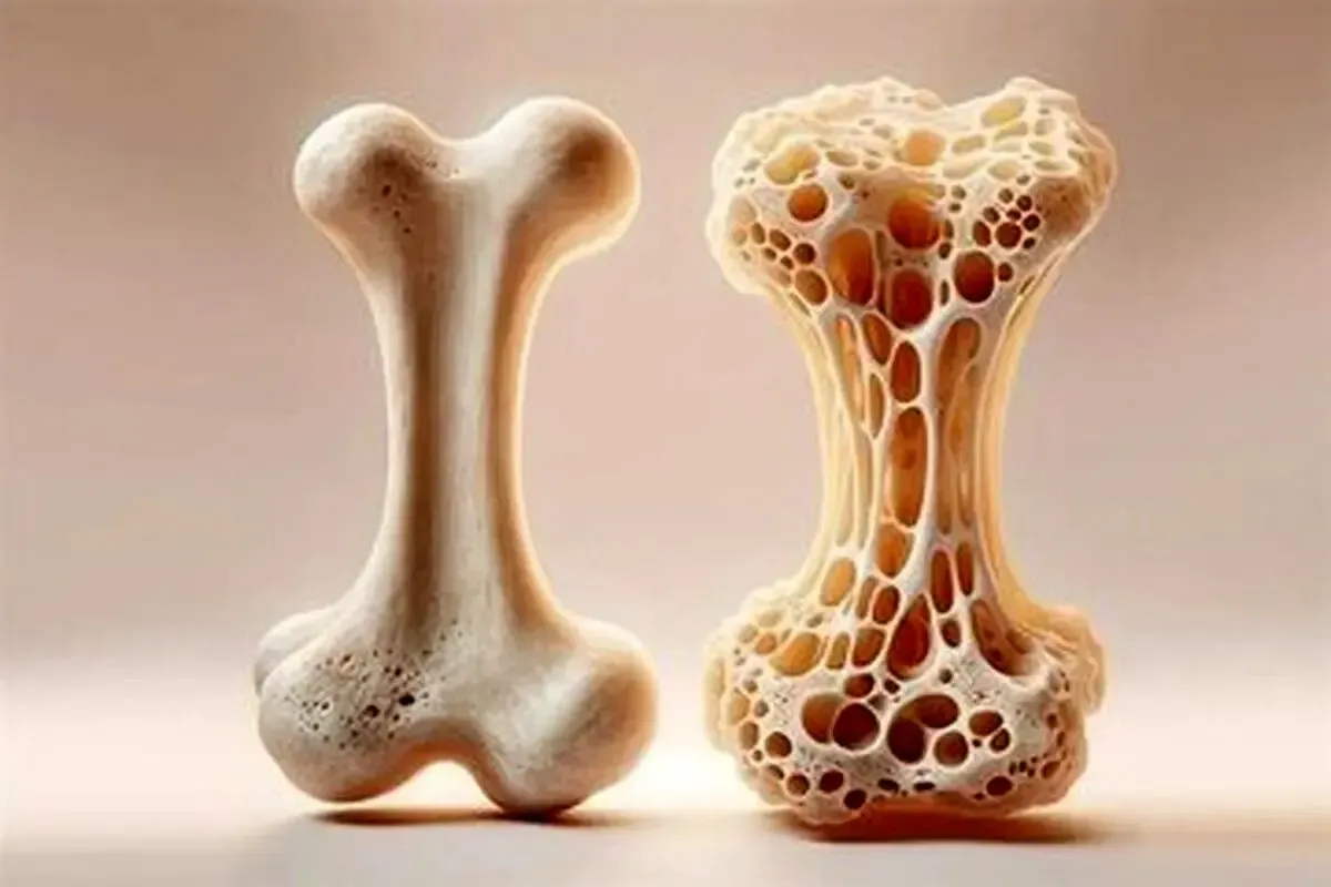 ۷ عادت هفتگی که موجب تقویت استخوان‌ها می شوند 1