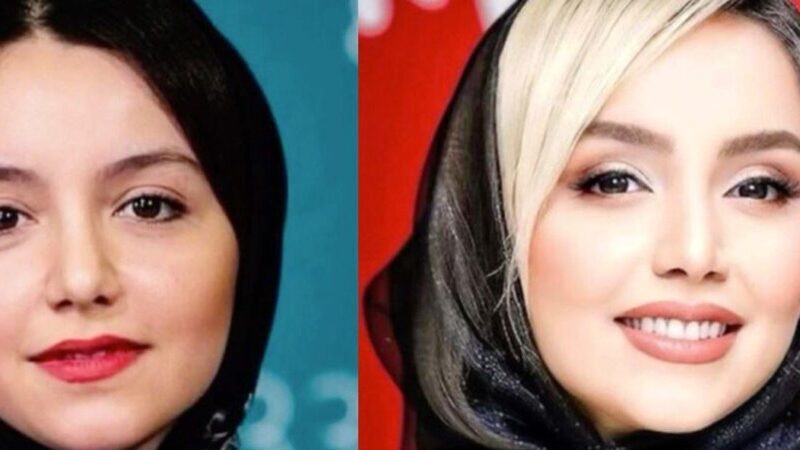 تصاویر | تغییر چهره نازنین بیاتی از گذشته تا امروز ؛ خانم بازیگر چه جراحی‌هایی انجام داده؟