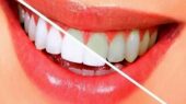 سلامت دهان را تضمین کنید؛ خوراکی هایی که مثل مسواک دندان هایتان را تمیز می‌کنند