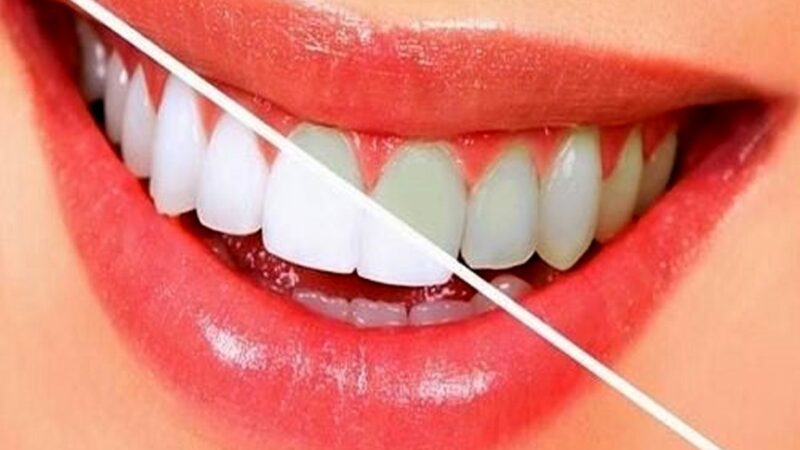 سلامت دهان را تضمین کنید؛ خوراکی هایی که مثل مسواک دندان هایتان را تمیز می‌کنند 