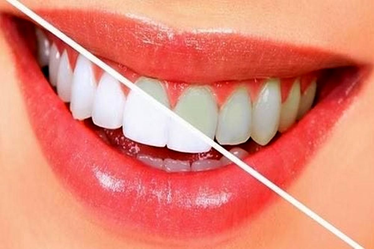 سلامت دهان را تضمین کنید؛ خوراکی هایی که مثل مسواک دندان هایتان را تمیز می‌کنند