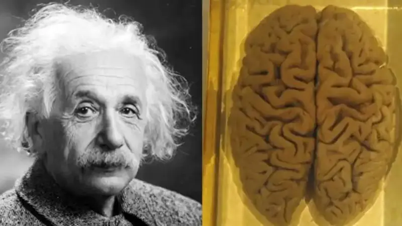 مغز آلبرت انیشتین چگونه دزدیده شد؟