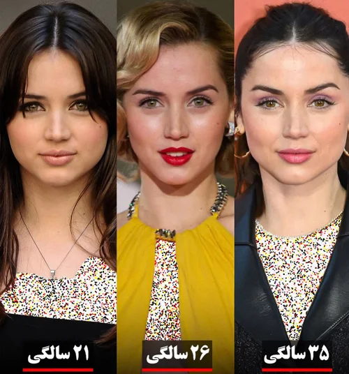 تغییر چهره آنا د آرماس