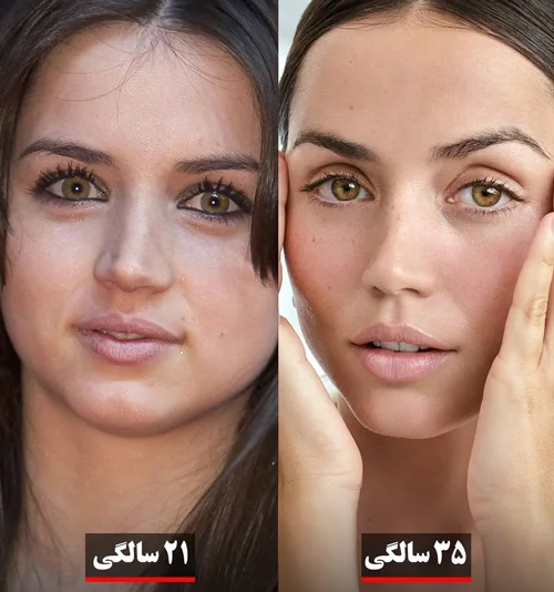 تغییر چهره آنا د آرماس