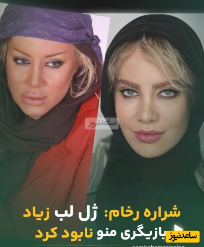 شراره رخام فاش کرد: چگونه تزریق ژل لب، بازیگری‌ام را به خطر انداخت؟ - تصویر شاخص