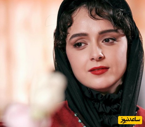 ترانه علیدوستی و نبرد سخت با بیماری نادر که زیبایی‌اش را تهدید کرد! - تصویر شاخص