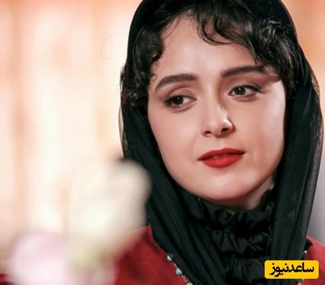 ترانه علیدوستی و نبرد سخت با بیماری نادر که زیبایی‌اش را تهدید کرد!