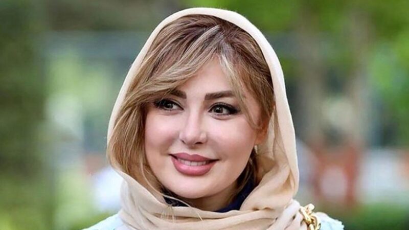 عکس| جدیدترین عکس نیوشا ضیغمی بعد از عمل دوباره بینی!