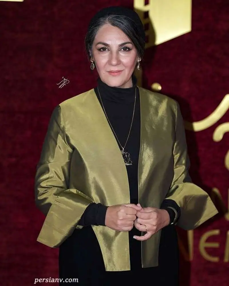 تغییر چهره بازیگر سریال «نرگس» بعد از ۱۹ سال!