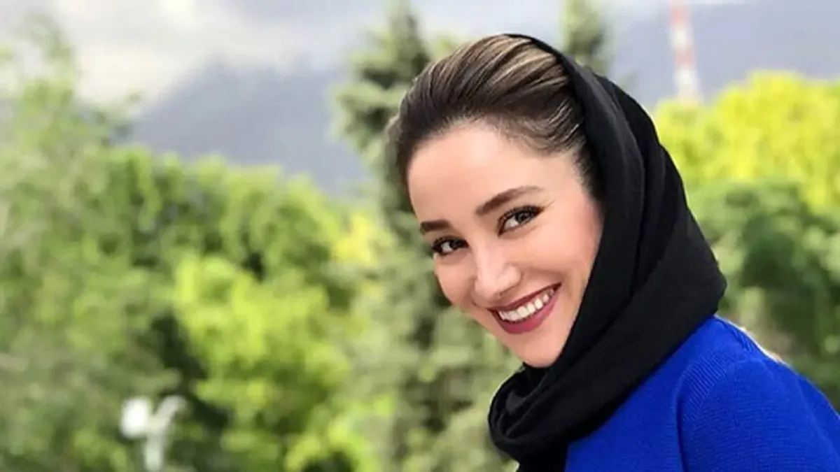 چهره بهاره افشاری ۲۰ ساله؛ خانم بازیگر از این رو به اون رو شده - فرهنگی