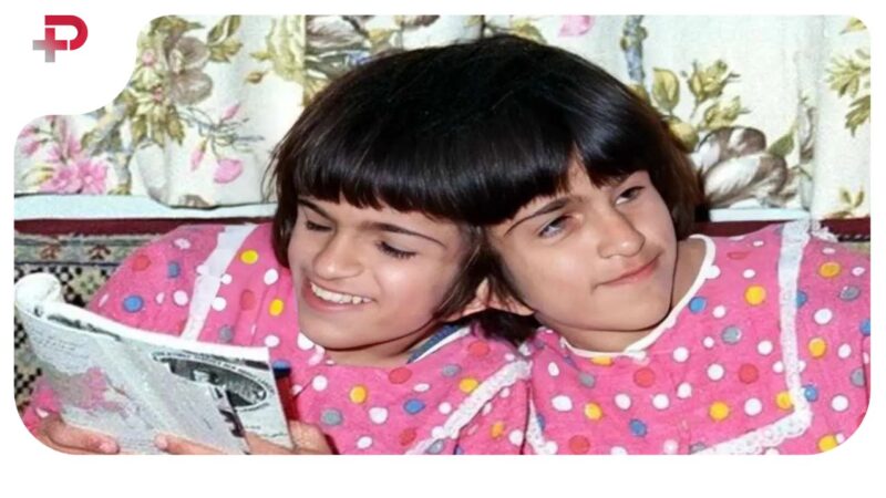 لادن و لاله دوقلوهای بهم چسبیده؛ حقایق واقعی زندگی پس از ۲۵ سال