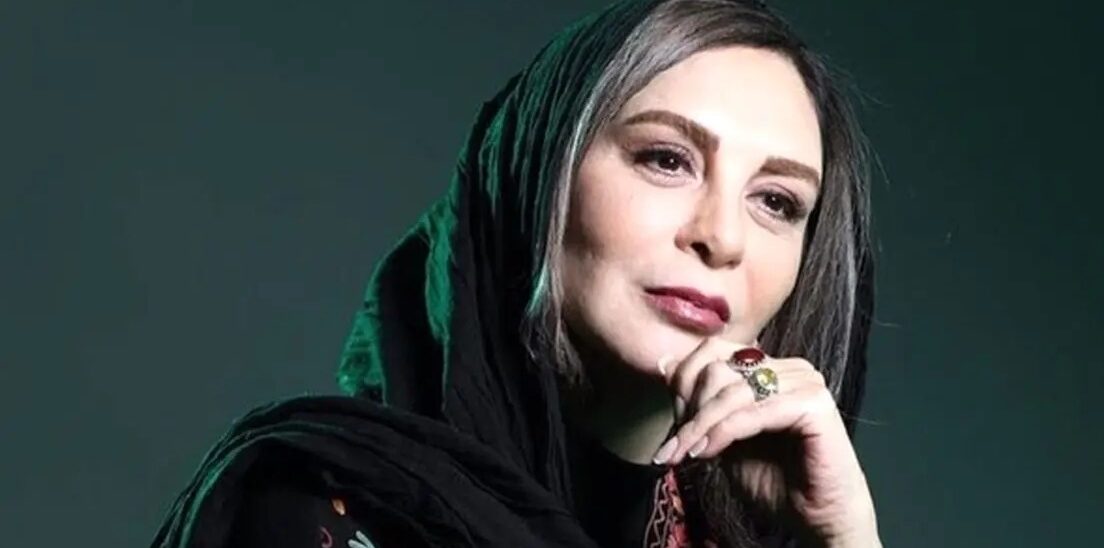 افسانه بایگان با چهره قبل عمل کنار خسرو شکیبایی؛ چقدر تغییر کرده - تصویر شاخص