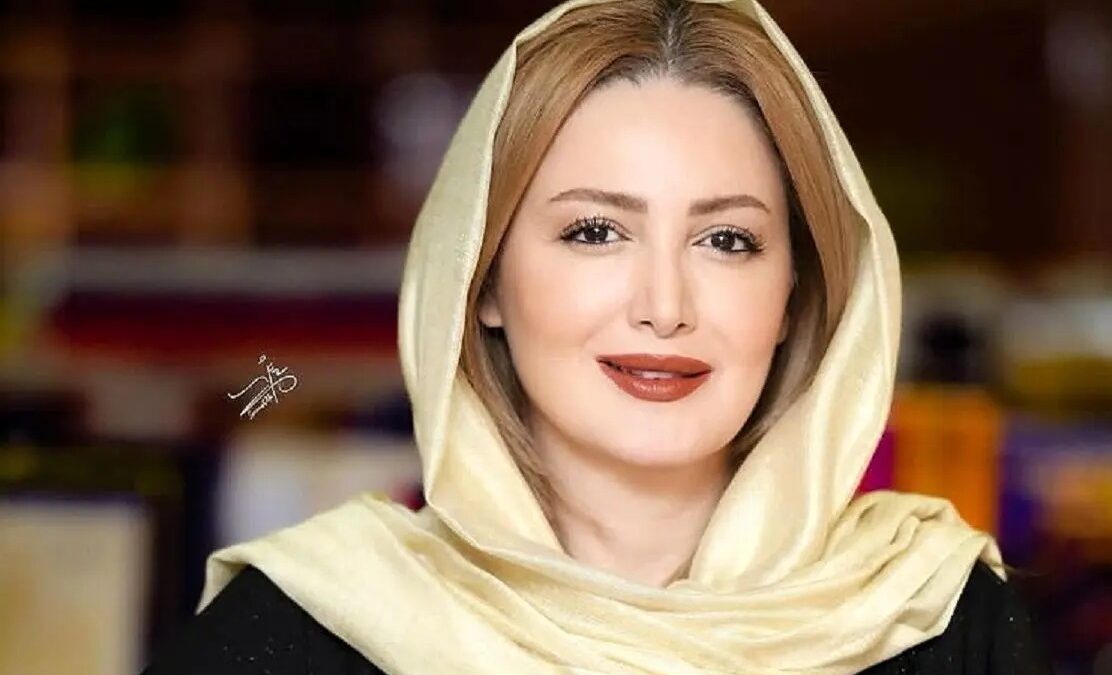 چهره قبل عمل شیلا خداداد در «عیسی میآید»؛ 25 سال قبل