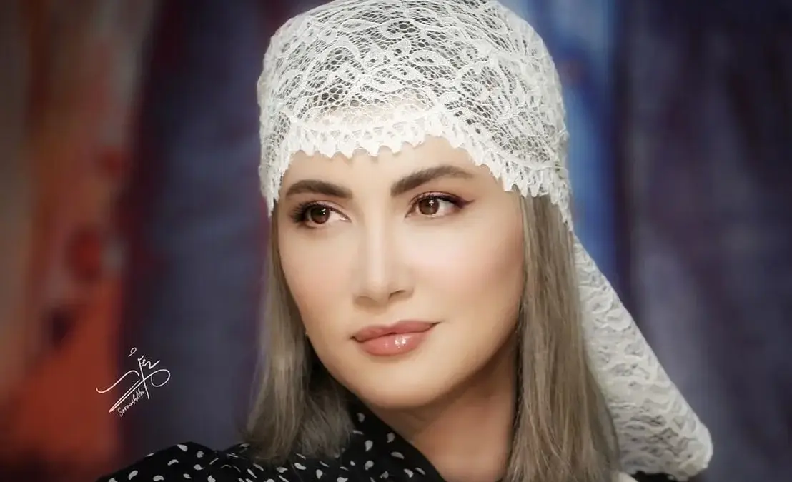عکس لورفته از چهره قبل عمل سمیرا حسینی؛ کوبیده از نو ساخته
