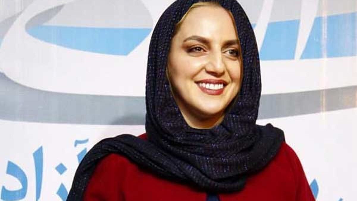 عکس| سفر در زمان؛ تغییره چهره عجیب «نسرین بابایی» یک سال بعد سریال فراری