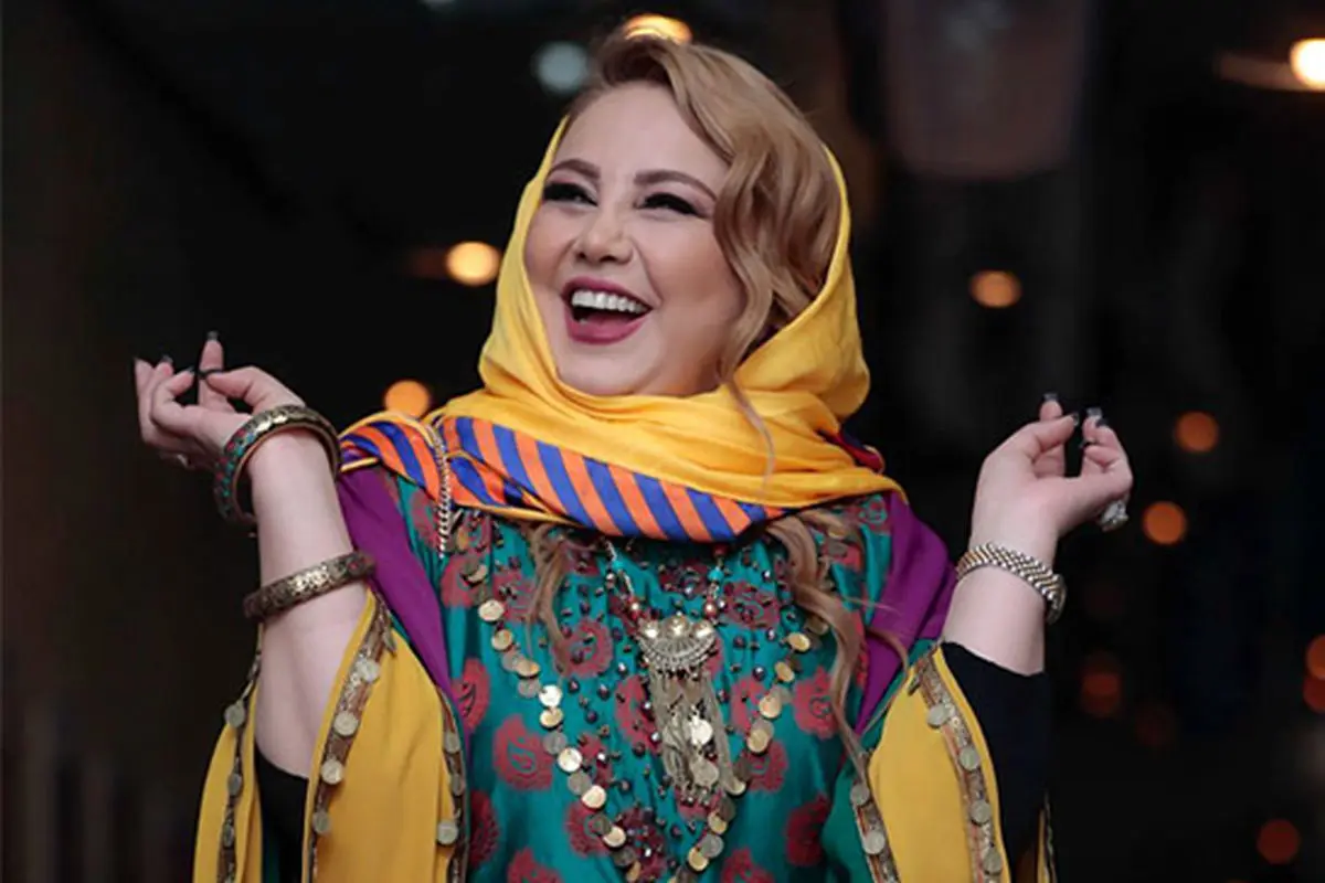 عکس| بهنوش بختیاری در کنار هما پوراصفهانی؛ هر دو چقدر عمل دارند - تصویر شاخص