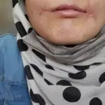 روایت تکان‌دهنده زن جوان از یک سال شکنجه در مشهد: شوهرش لب‌هایش را با نخ و سوزن دوخت!