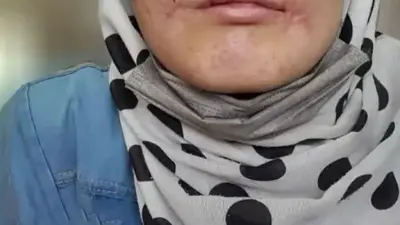 روایت تکان‌دهنده زن جوان از یک سال شکنجه در مشهد: شوهرش لب‌هایش را با نخ و سوزن دوخت!