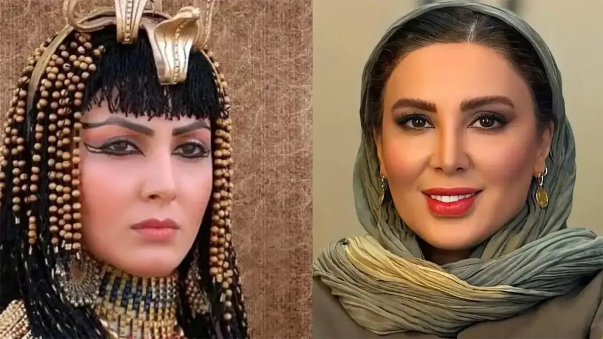 لیلا بلوکات به شایعه ۳۰ عمل زیبایی پاسخ داد: یک بار جراحی کردم