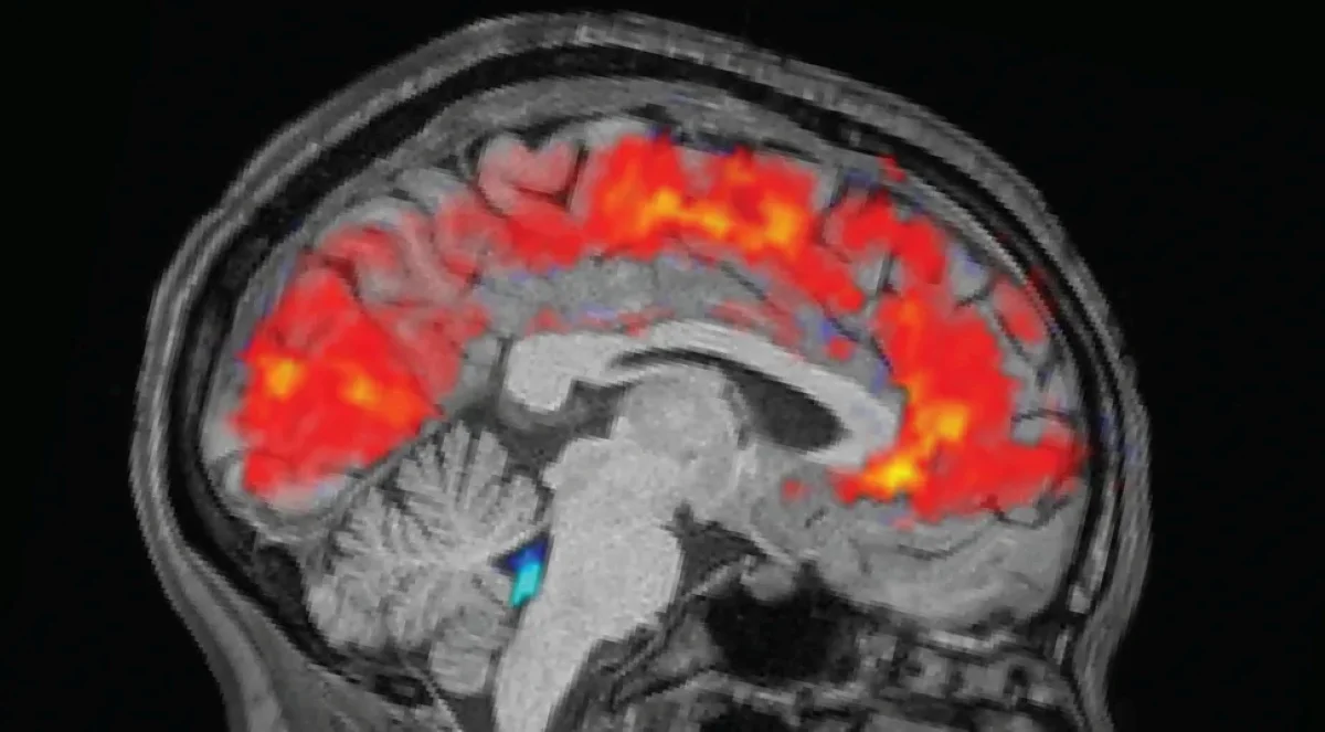 brain فقط یک هفته مدیتیشن میتواند تغییرات چشمگیری در مغز ایجاد کند | دیجینوی