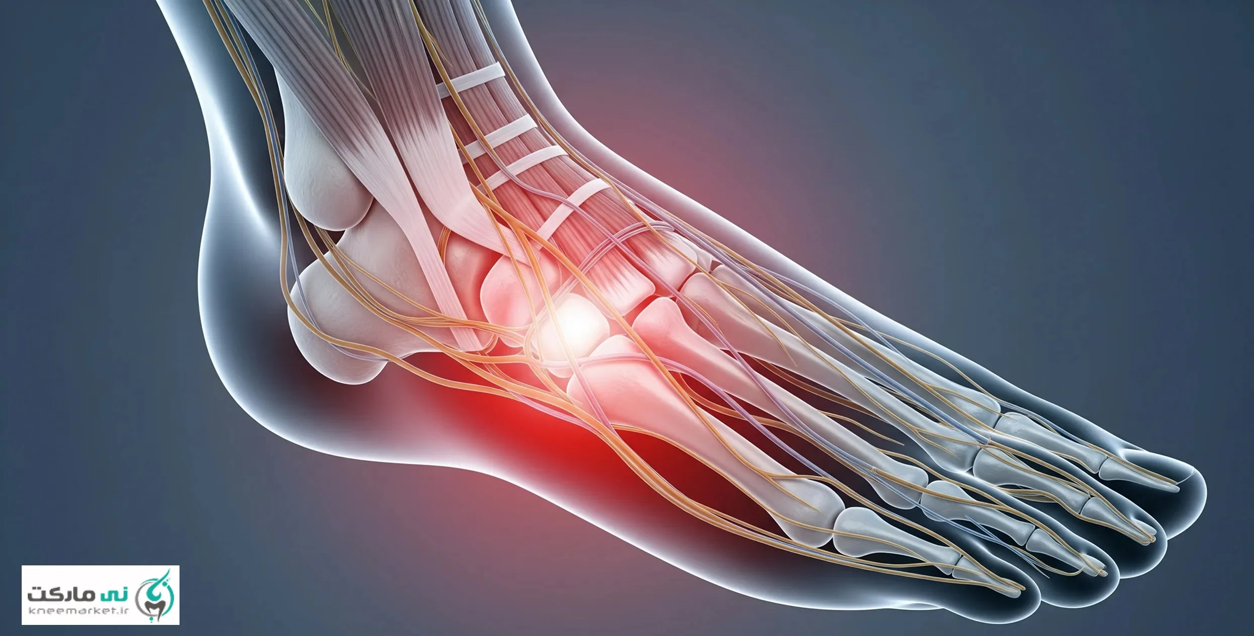 foot pain
