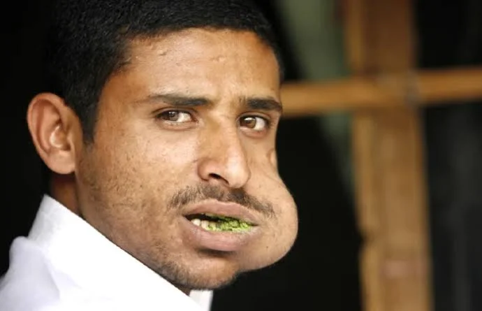 گیاه قات