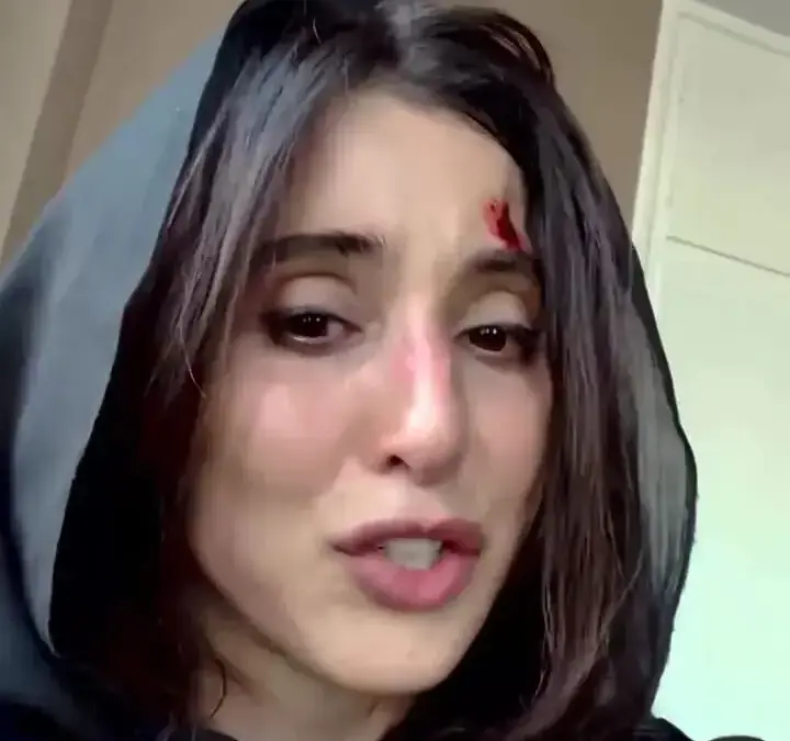 واکنش جنجالی آناهیتا افشار به انتشار کلیپ اشک‌آلود؛ پشت پرده‌ای که همه را شوکه کرد!