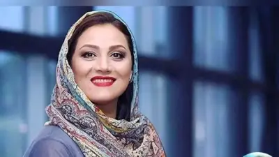 تغییر چهره جنجالی شبنم مقدمی / خانم بازیگر قابل شناسایی نیست