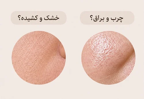 نوع منافذ پوست