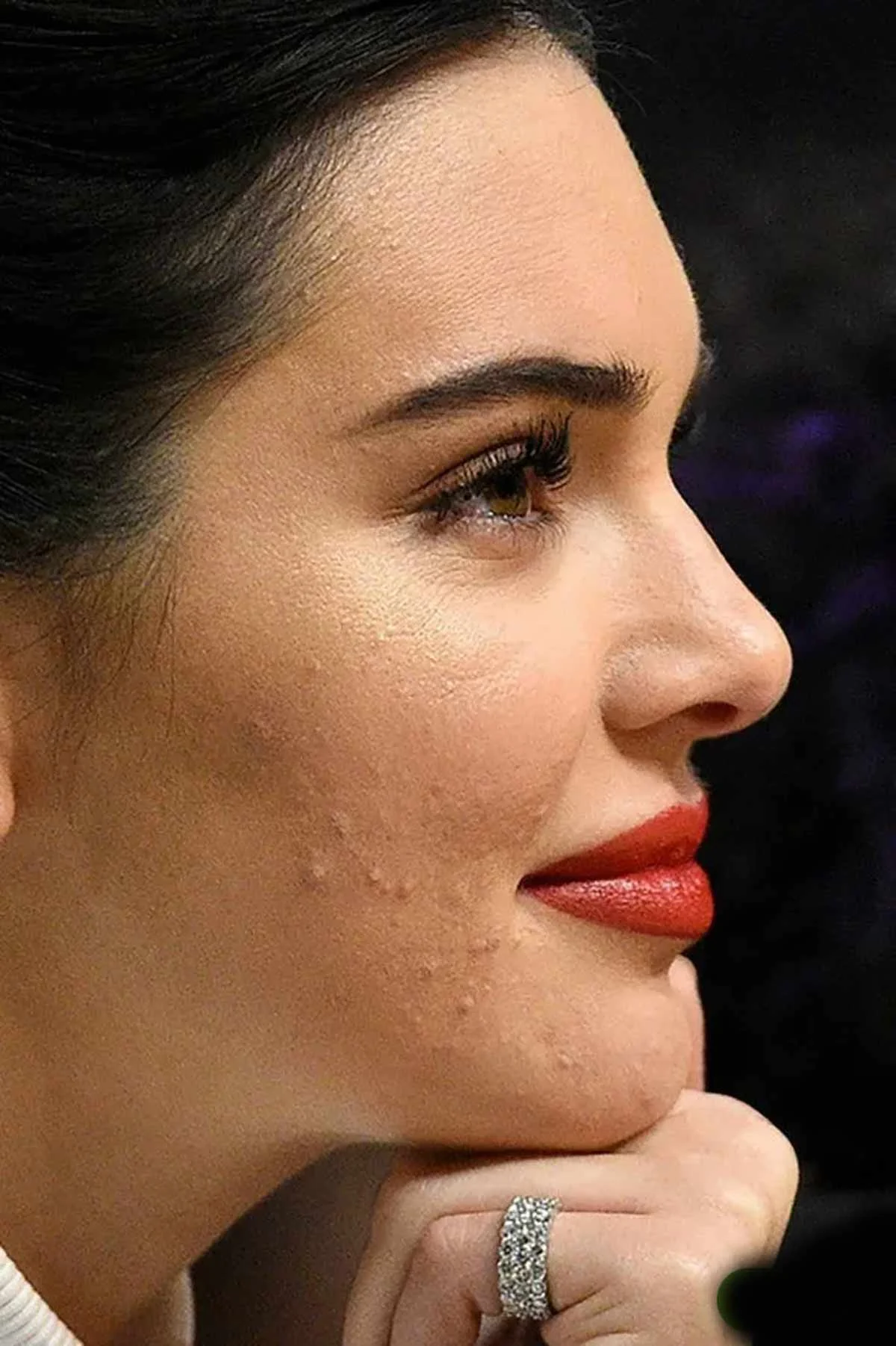 کندال جنر